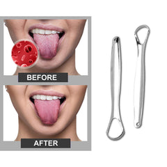 2-Pack: Stainless Steel Tongue Cleaner Scraper For Oral Hygiene and Fresh Breath