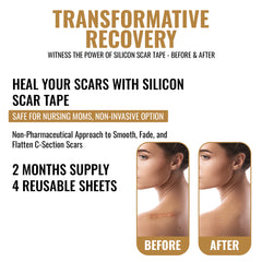 Scar Away Silicone Scar Sheets Tape (5.9"x 1.6”) Removal for Surgical, Keloid, C-Section, Acne Burns & Tummy Tuck Scars (4 Sheets)
