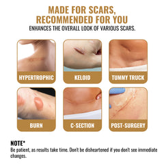 Scar Away Silicone Scar Sheets Tape (5.9"x 1.6”) Removal for Surgical, Keloid, C-Section, Acne Burns & Tummy Tuck Scars (4 Sheets)