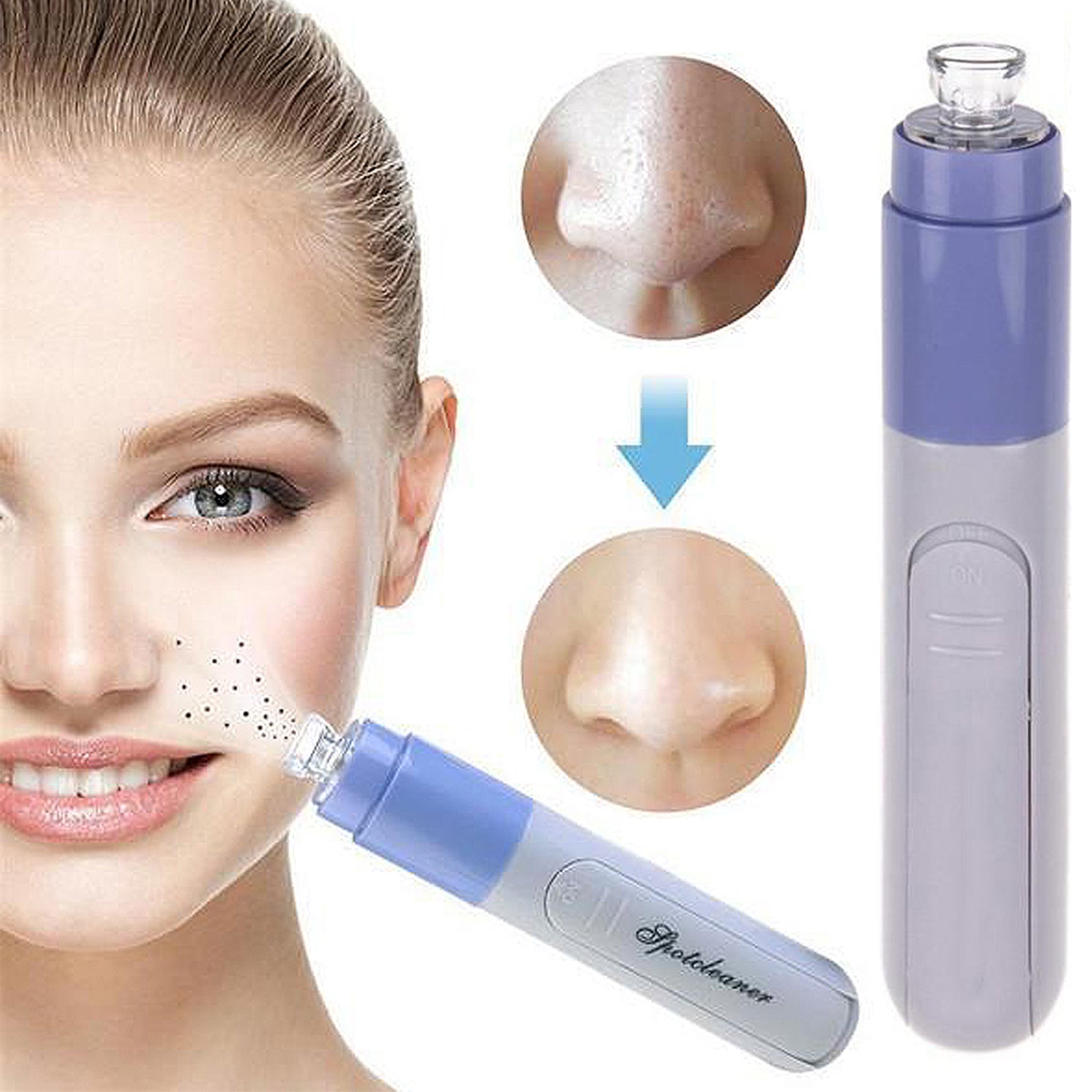 Facial Pore Cleanser, Battery-Operated Suction Skincare Tool, 1 or 2 Pack